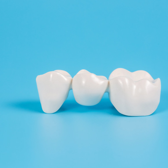 Close-up of a dental bridge in Altavista, VA on a blue background
