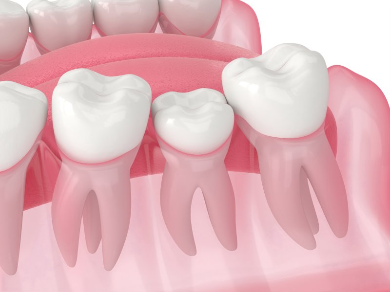 Causes of Shifting Teeth | Hooks Family Dentistry
